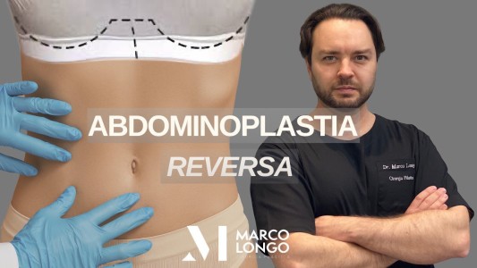  abdominoplastia reversa